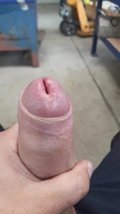 Foreskin down