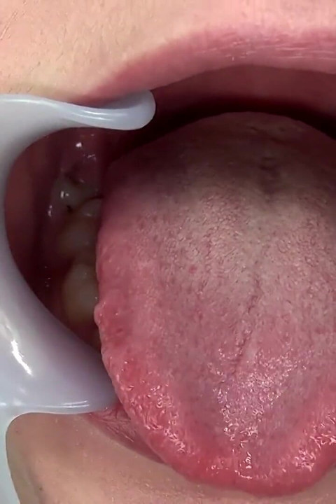 Dental Examination with Clara Luroa