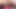 Crazy Anal Exam Gaping Farting Dildo Fuck with Huge Cum