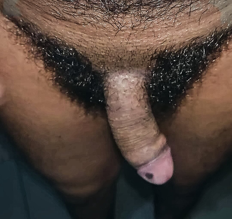 Bigg Dick my dick mole thick dick big dick