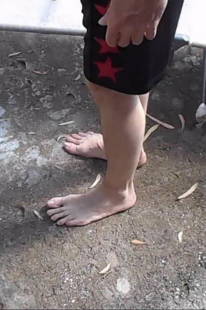 Puzanje po prljavim bosim stopalima na otvorenom
