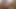 LizzyYum January 19 2024 DILATING 01 Post Op Orgasm Pussy anal Masturbation Teasing