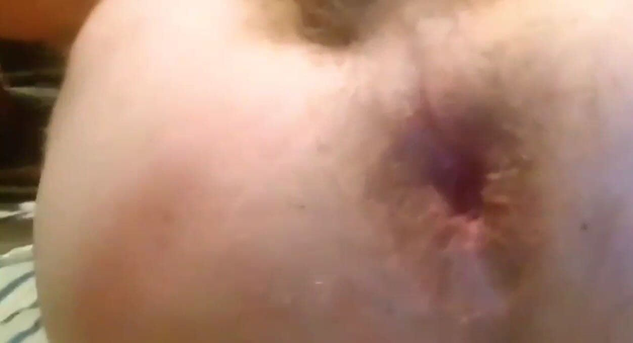 Anal masturbation