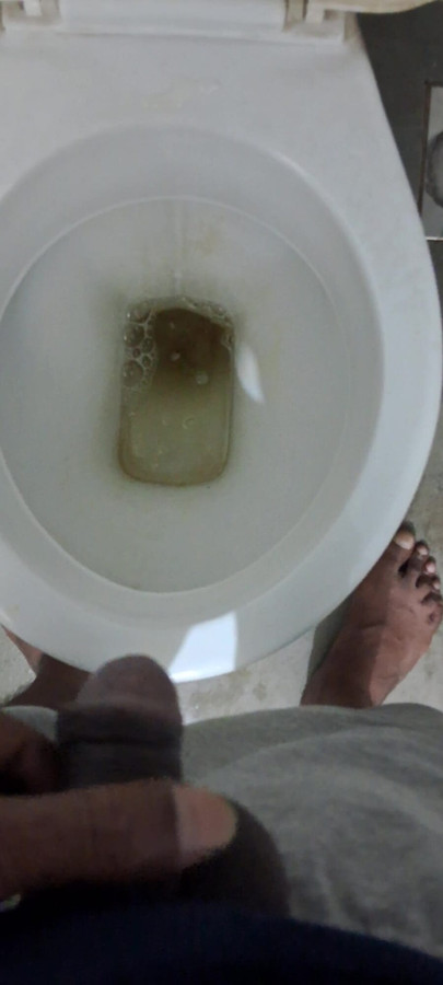 膀胱だらけの放尿