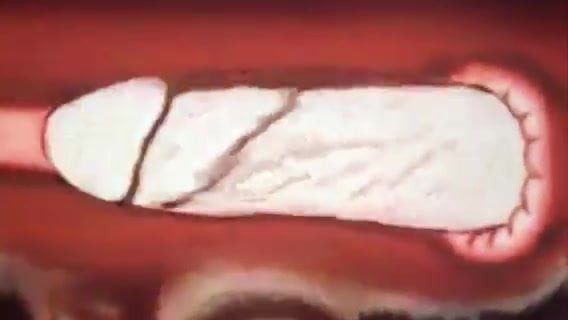 Analna animacija