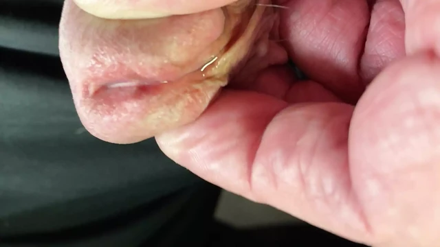 A couple of close ups