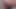 ass enlargement  different dildos