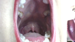 Inside My Big Mouth Tongue Teeth Uvula