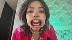 Cheeks Pulled Apart Teeth Exposed