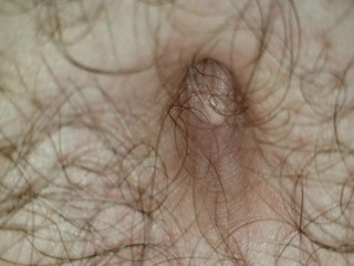 My Belly Button