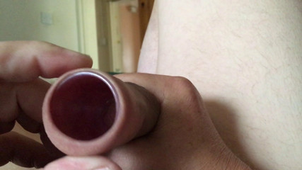 Plastic cap in foreskin