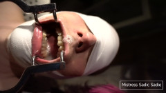 Spit and More Spit! Let Me Just Cover You!