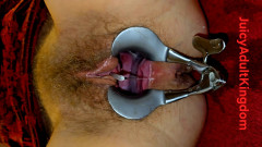 The Speculum widely spreads my vagina and a long tube is inserted into my urethra.