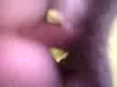 /beam/686995