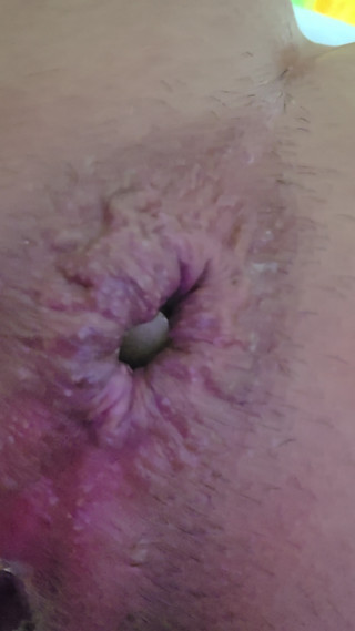 Close-up of a bottle inserted into the anus…