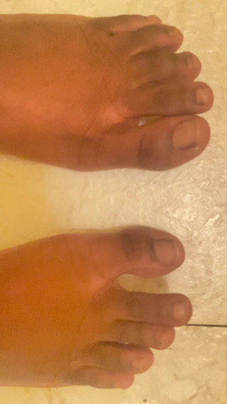 Can I Put These Toes In Your Mouth , Yes Or No ???????