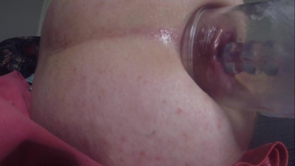 Anal Pumping and Plug Tunel