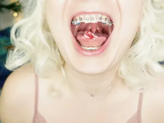 BRACES fetish: ASMR video of eating MUKBANG..