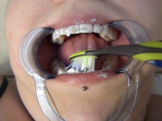 Dentist Probes Naughty Girl&#039;s Mouth