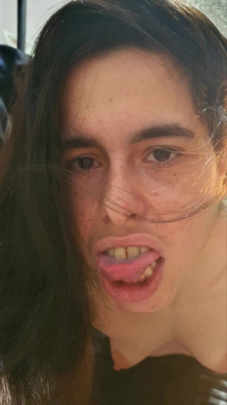 Hairy