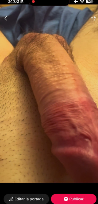 Masturbation