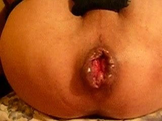 natural gaping anal for sissy slut
