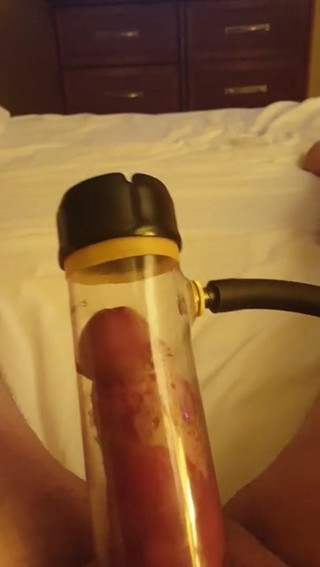 Venus 2000 Penis Pump Attachment P1