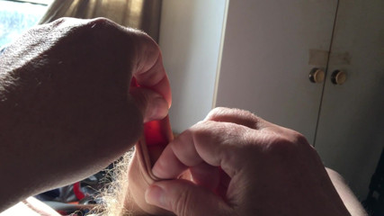 Sunshine foreskin - 6 of 8