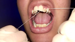 Trying to Use Dental Floss (close-up)