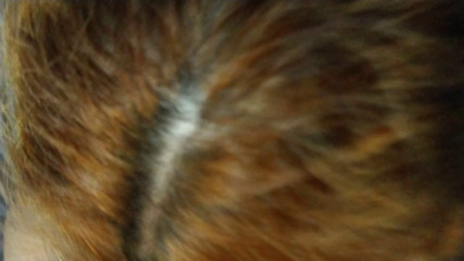 /beam/20049115