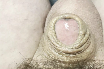 Micro penis pre- cum over flow