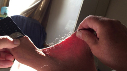 Sunshine foreskin five minute video - phone
