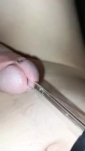 young inserts a tube into the urethra of a small dick