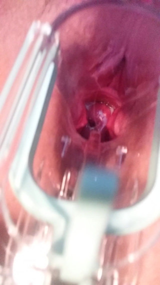 Cumming w speculum
