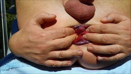 My Fuckhole My Extreme Asshole Gape And Prolapse