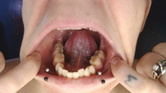 Climb Inside Wide Open Teeth Tongue Mouth Show