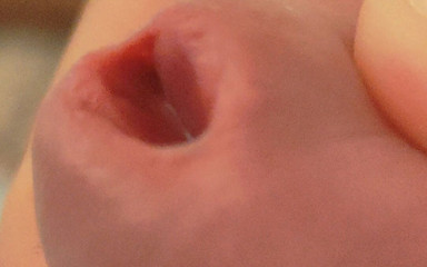 Amazing Closeup of the Widened Hole!!