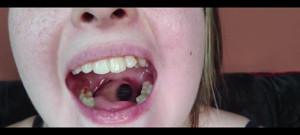 My Mouth, Teeth, Tongue and Throat up Close