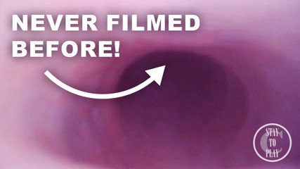 FISRT EVER POV COMSHOT FROM INSIDE THE PROSTATE thumbnail