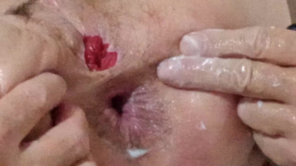 lizzy yum SD December 2025 post op shemale masturbating #56