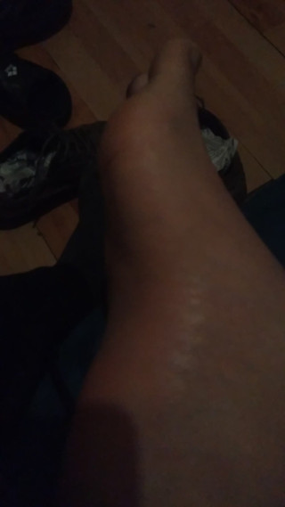 My soles of my feet thumbnail