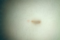Wet belly button