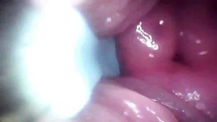 /beam/67a86332cc498f247e918f4d