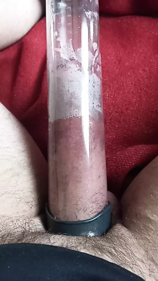 Eric's exploded ass.