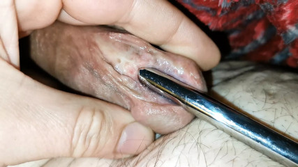 Subincision, sounding, estim