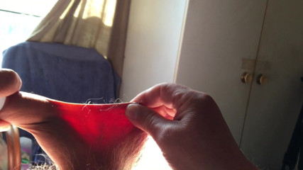 Sunshine foreskin - 7 of 8