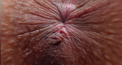 You never see beauty ass hole so clouse