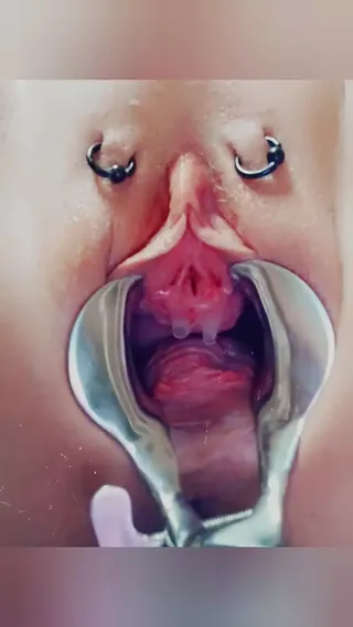 /beam/67a8633ecc498f247e922a6d