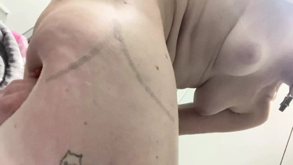 Naked at Heathrow and massaging my scarred thigh and ass because cancer in the mid 90's has left it ruined