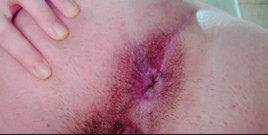 My Hairy Asshole Wants You to Lick It and Enjoys Getting Really Close to Your Face